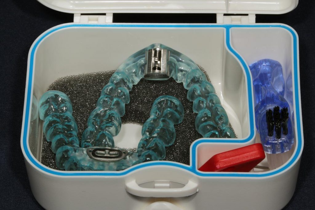 TAP®-Schienen – Roß Dental Technik